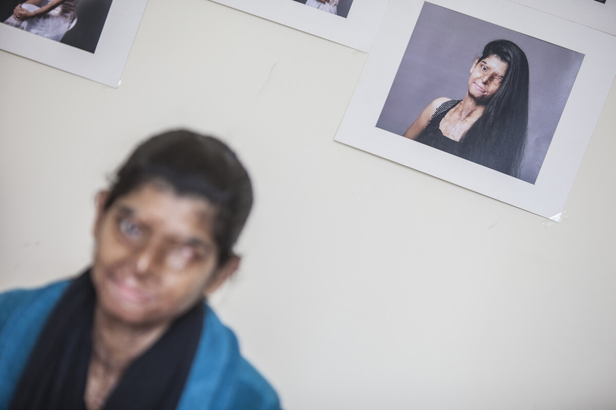 Acid attacks, India 2015