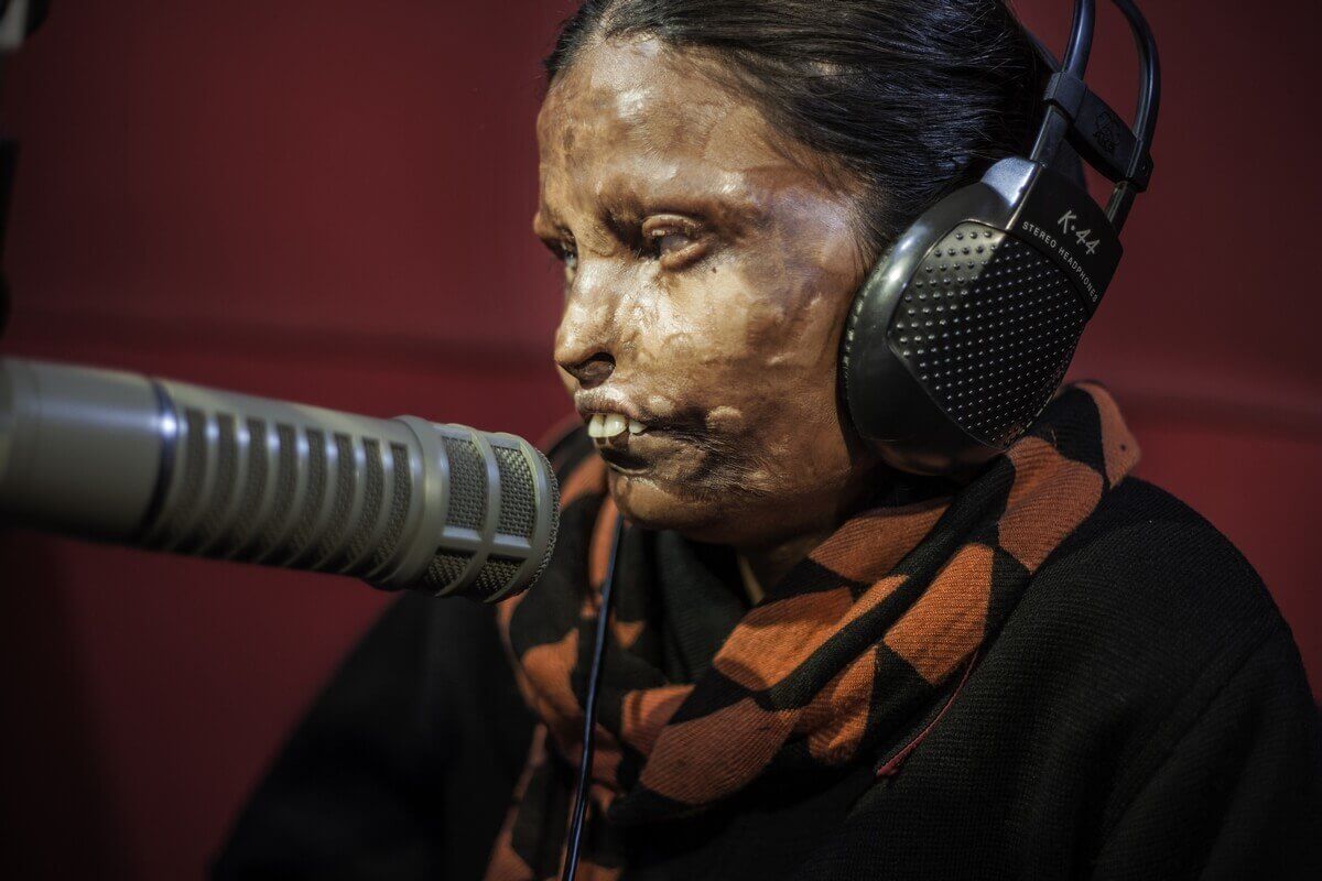 Acid attacks, India 2015